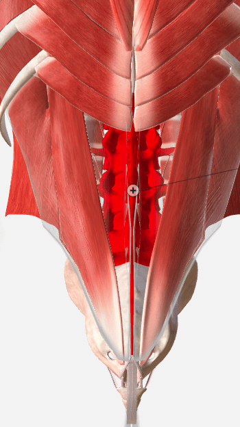 Lumbalgia